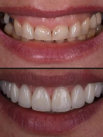 Digitális Smile Design