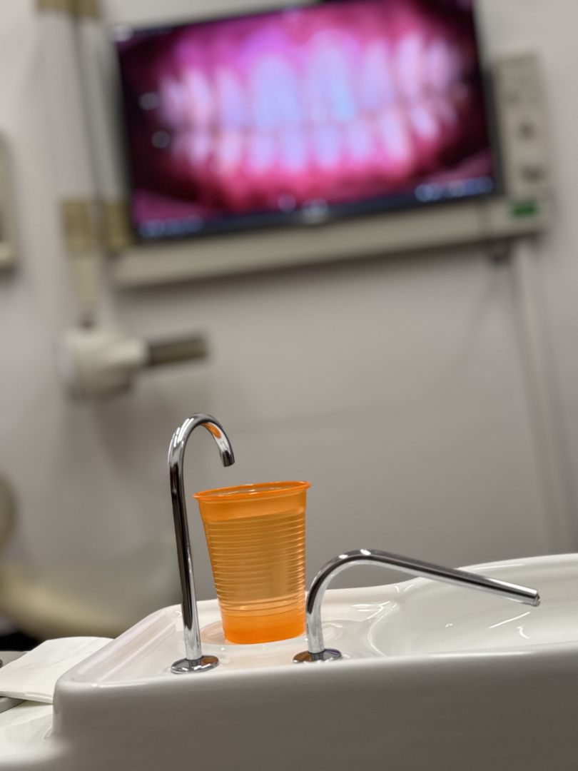 így zajlik egy fogászati kezelés a Smile Centerben