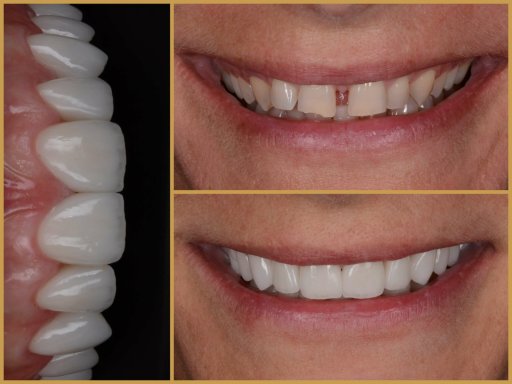 Dr. Bodrogi Attila munkái