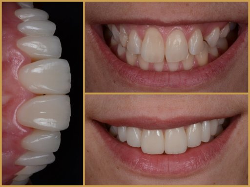 Dr. Bodrogi Attila munkái