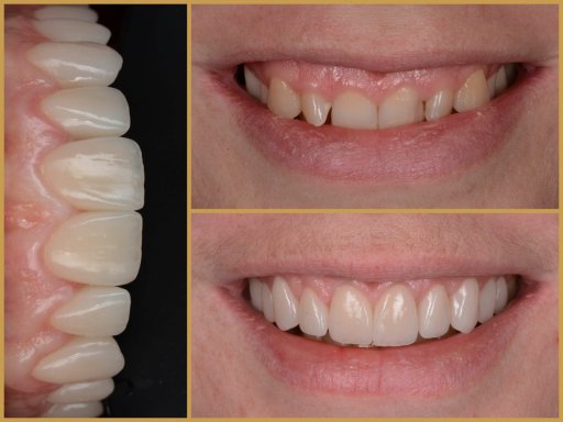 Dr. Bodrogi Attila munkái