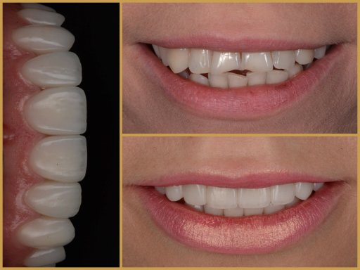 Dr. Bodrogi Attila munkái