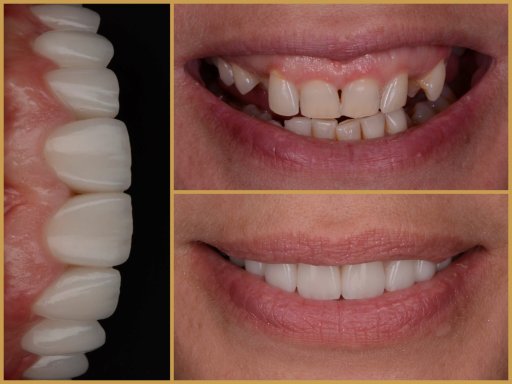 Dr. Bodrogi Attila munkái