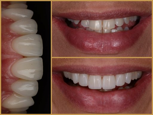 Dr. Bodrogi Attila munkái