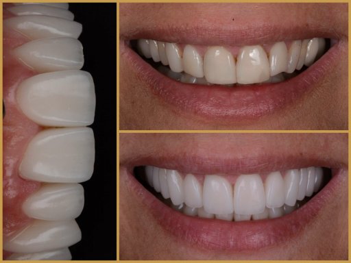 Dr. Bodrogi Attila munkái