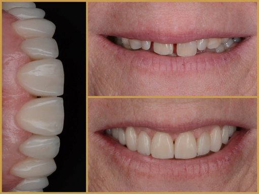 Dr. Bodrogi Attila munkái