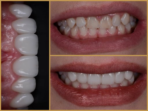 Dr. Bodrogi Attila munkái