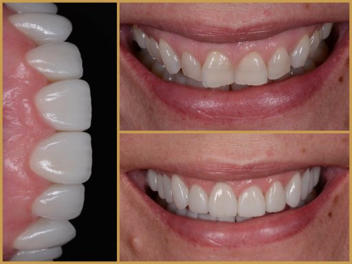 Dr. Bodrogi Attila munkái