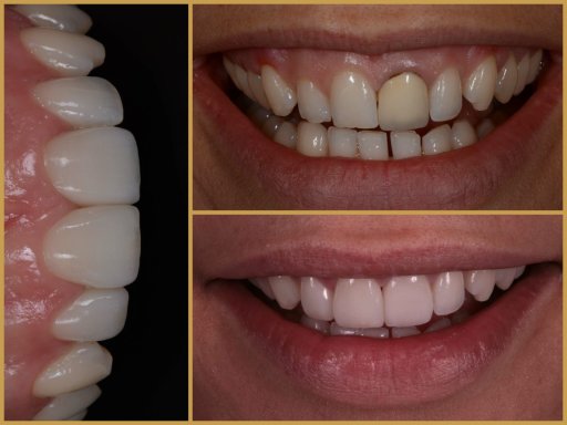 Dr. Bodrogi Attila munkái