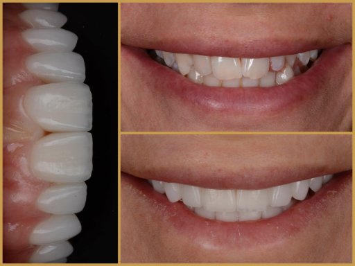 Dr. Bodrogi Attila munkái