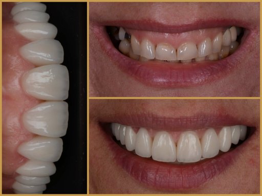 Dr. Bodrogi Attila munkái