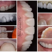 porcelanhej-keramiahej-01