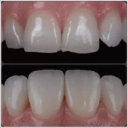 porcelanhej-keramiahej-02