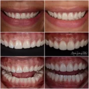 porcelanhej-keramiahej-04