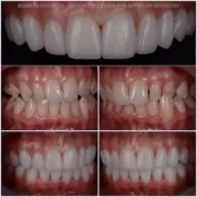 porcelanhej-keramiahej-05