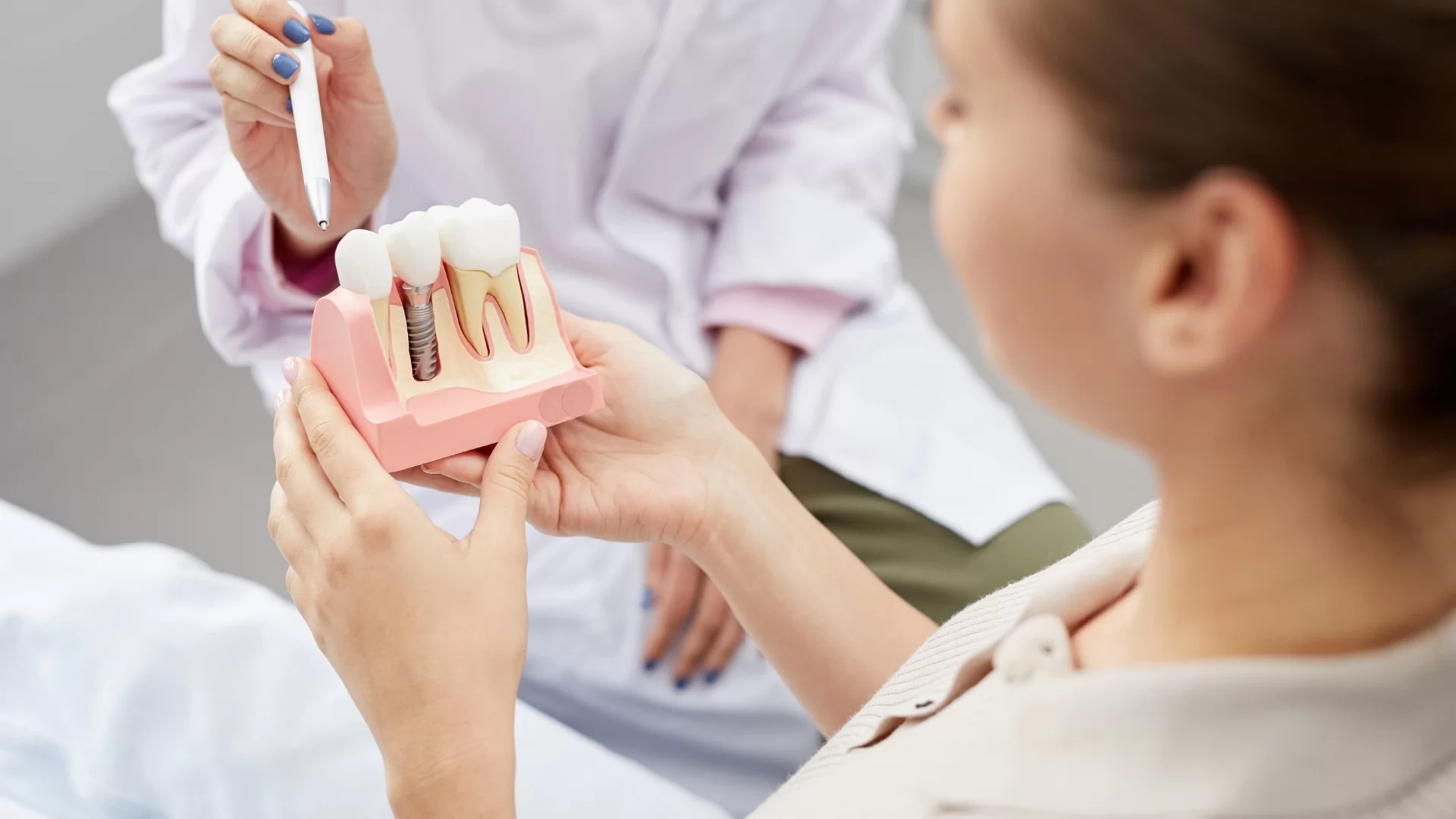 Mi is az a fogászati implantátum?