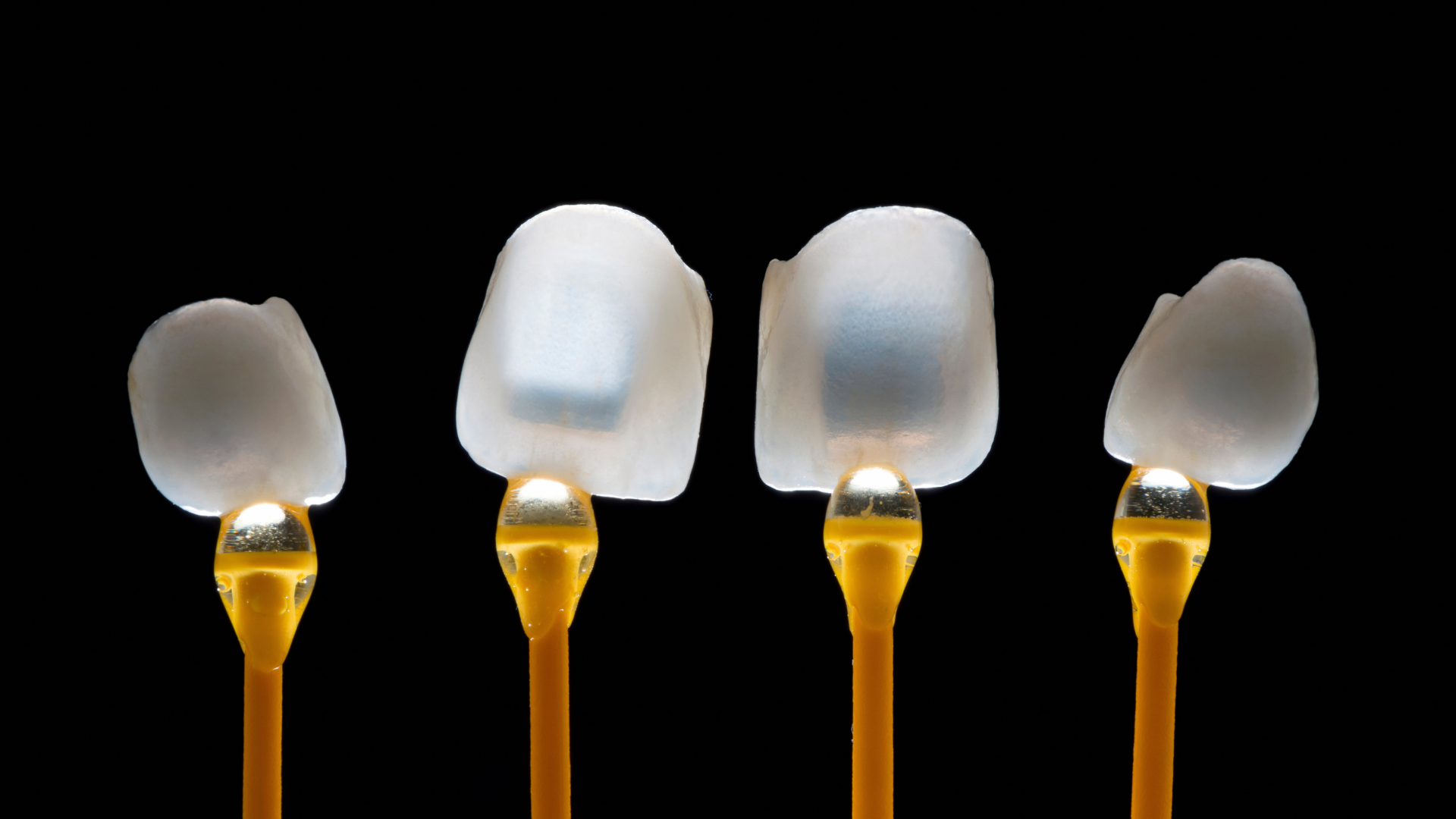 Porcelánhéj: kinek a megfelelő választás?