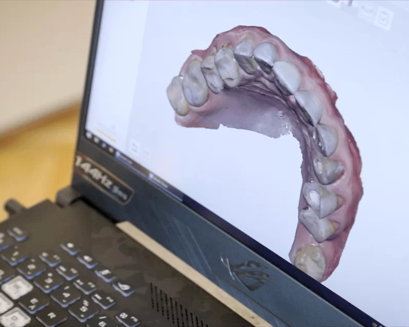 esztétikai fogászati kezelések