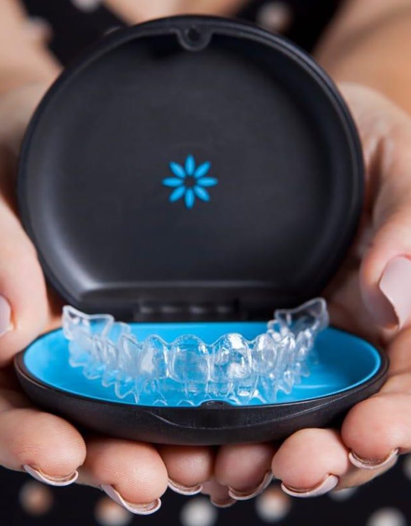 Mi az a láthatatlan fogszabályozó és hogyan működik?