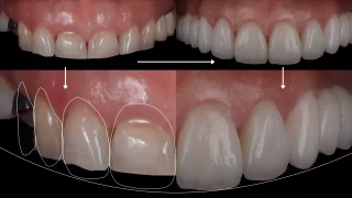 digitális smiledesign