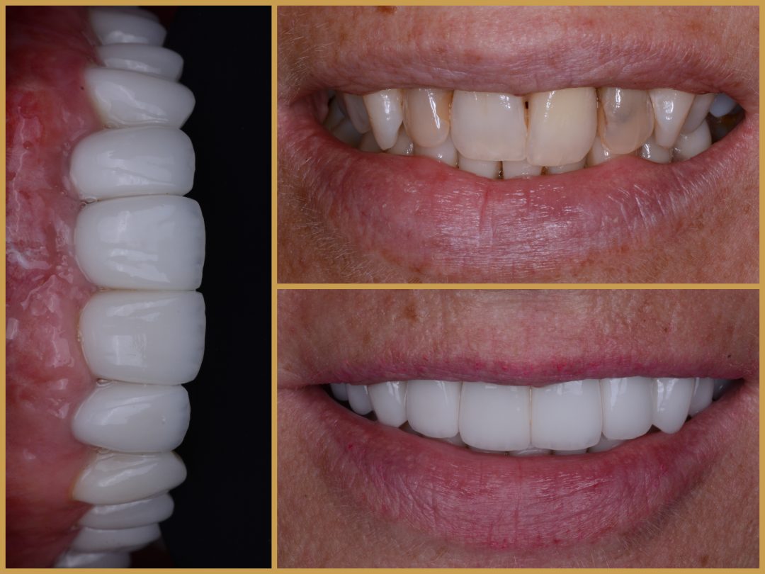 Magán fogorvos Budapesten előtte-utána