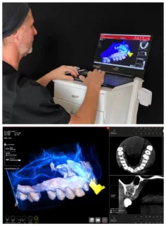 SmileCenter_Fogimplantacio-2-2