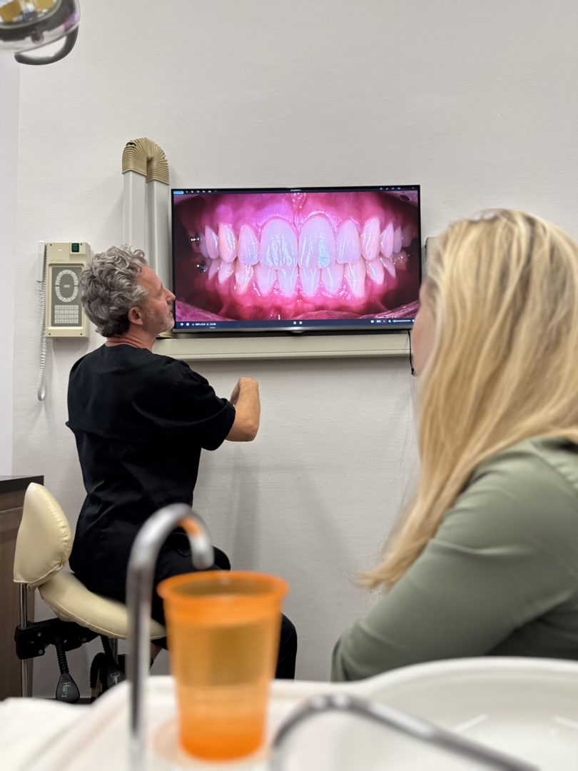 Teljes szájrehabilitáció