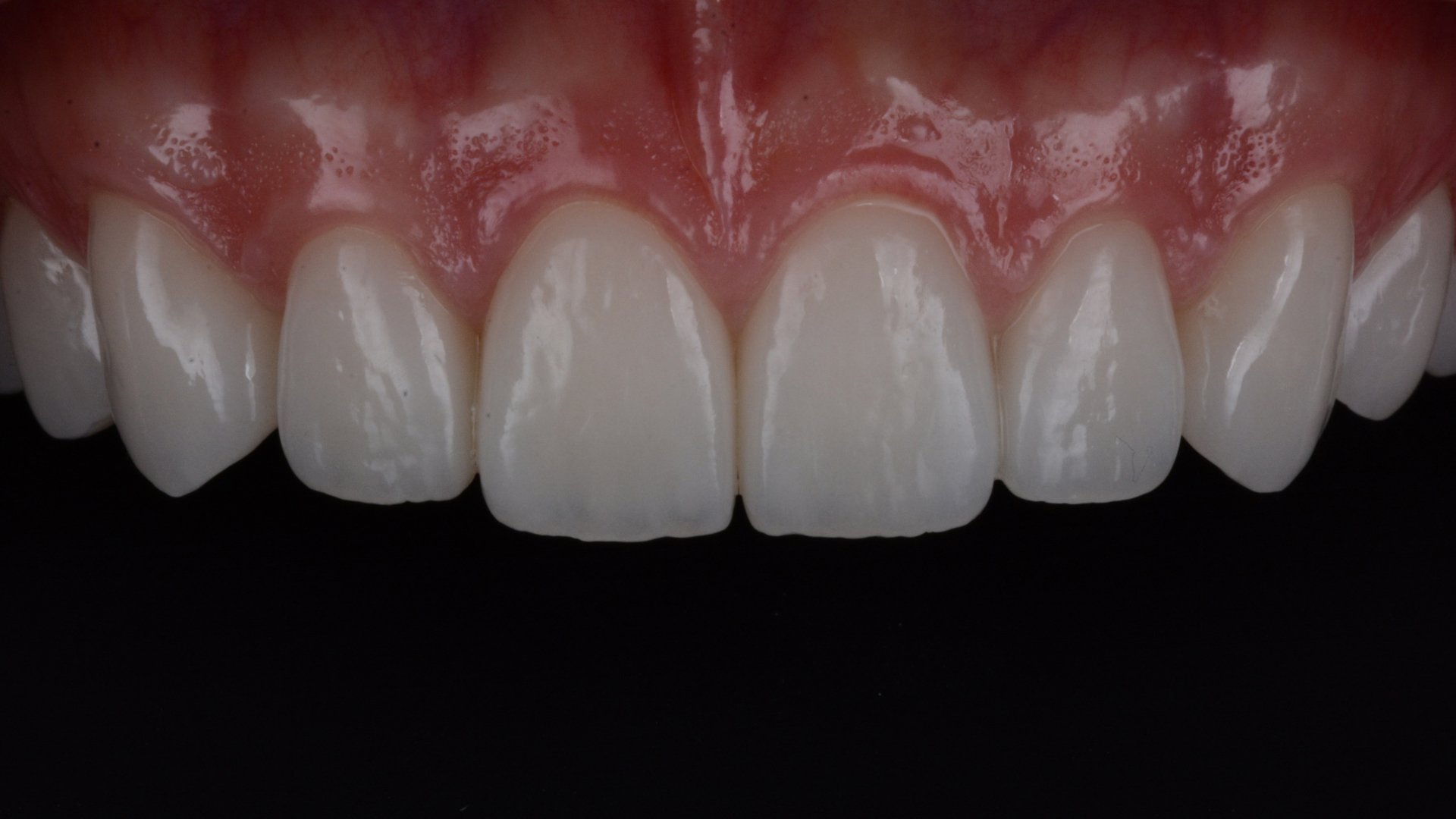 Kozmetikai fogászat