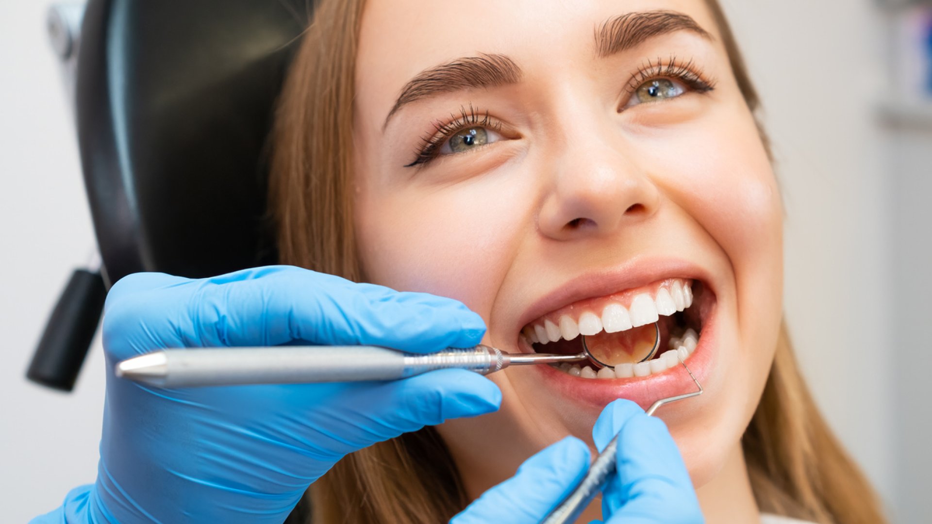 Esztétikai fogászat árak – mitől függ a mosolyátalakítás költsége?