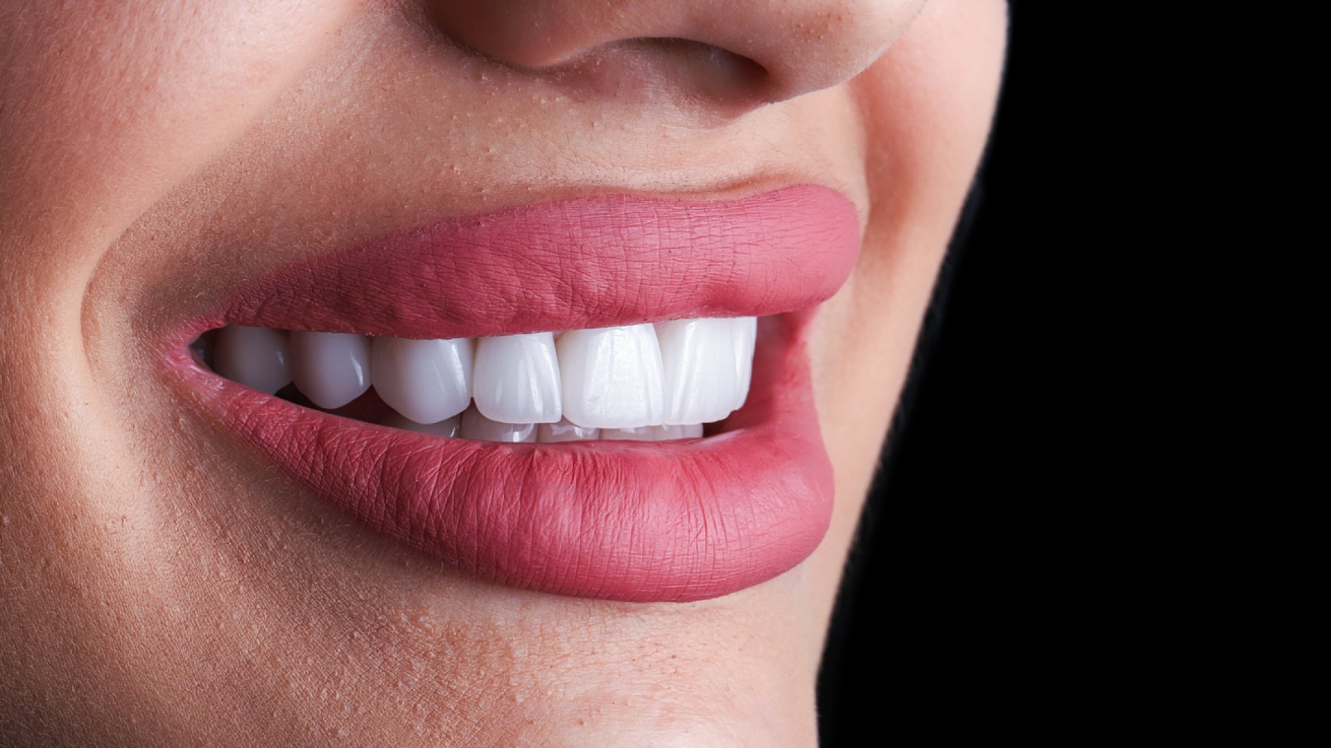 A cirkon korona előnyei és tudnivalók | SmileCenter