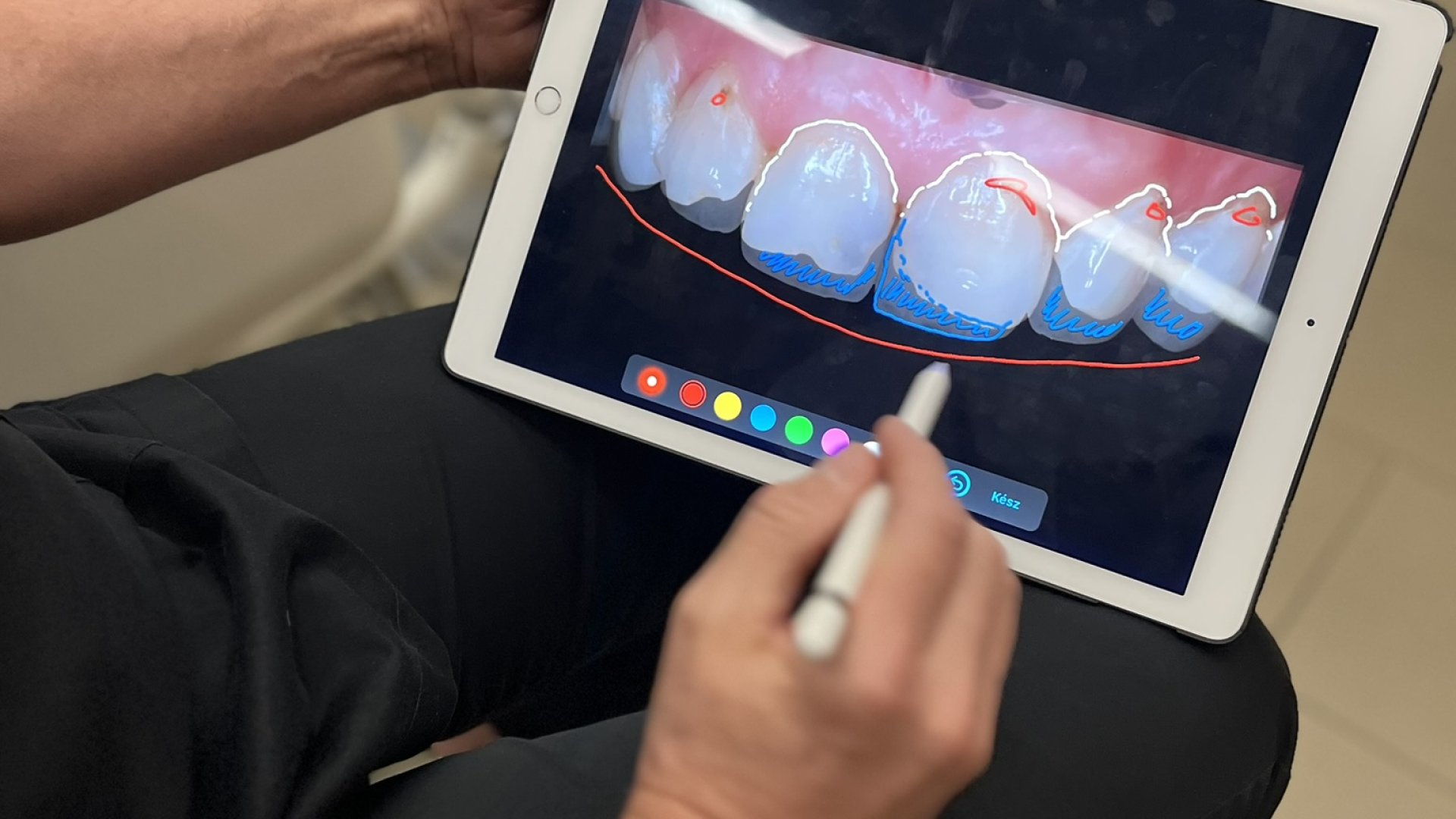 Mosolytervezés ár Budapesten | Digitális mosolyterv | SmileCenter