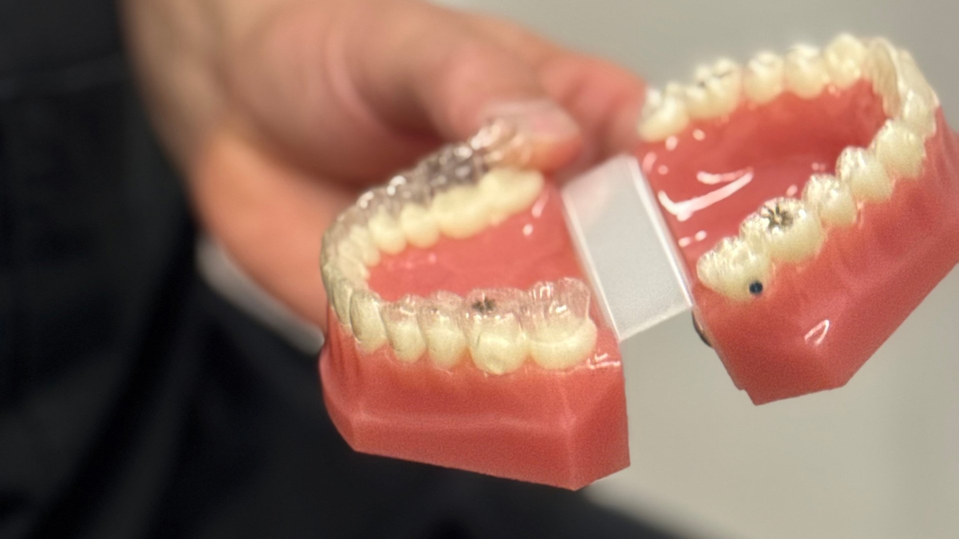 Invisalign Budapest