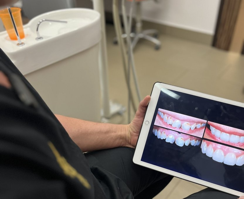 Fogászati implantáció