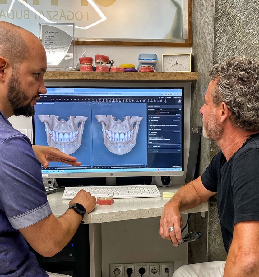 fogszabályozás felnőtteknek