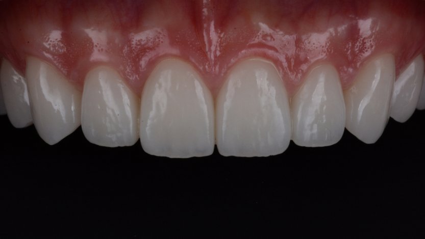 Kozmetikai fogászat