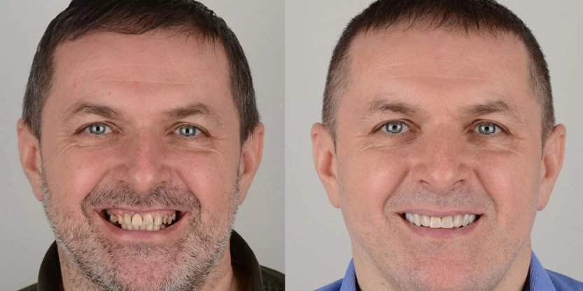 digitális mosolytervezés Budapesten