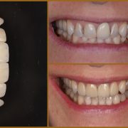 SmileCenter mosolyalbum - Dr. Szárkiszján Edina